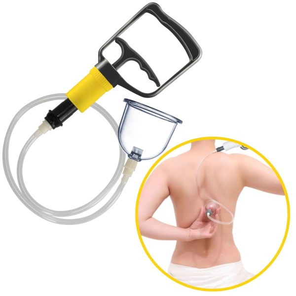 Масажні банки Fizio, 12 шт