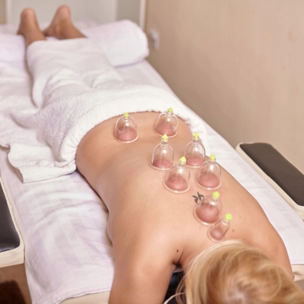 Масажні банки Fizio, 12 шт